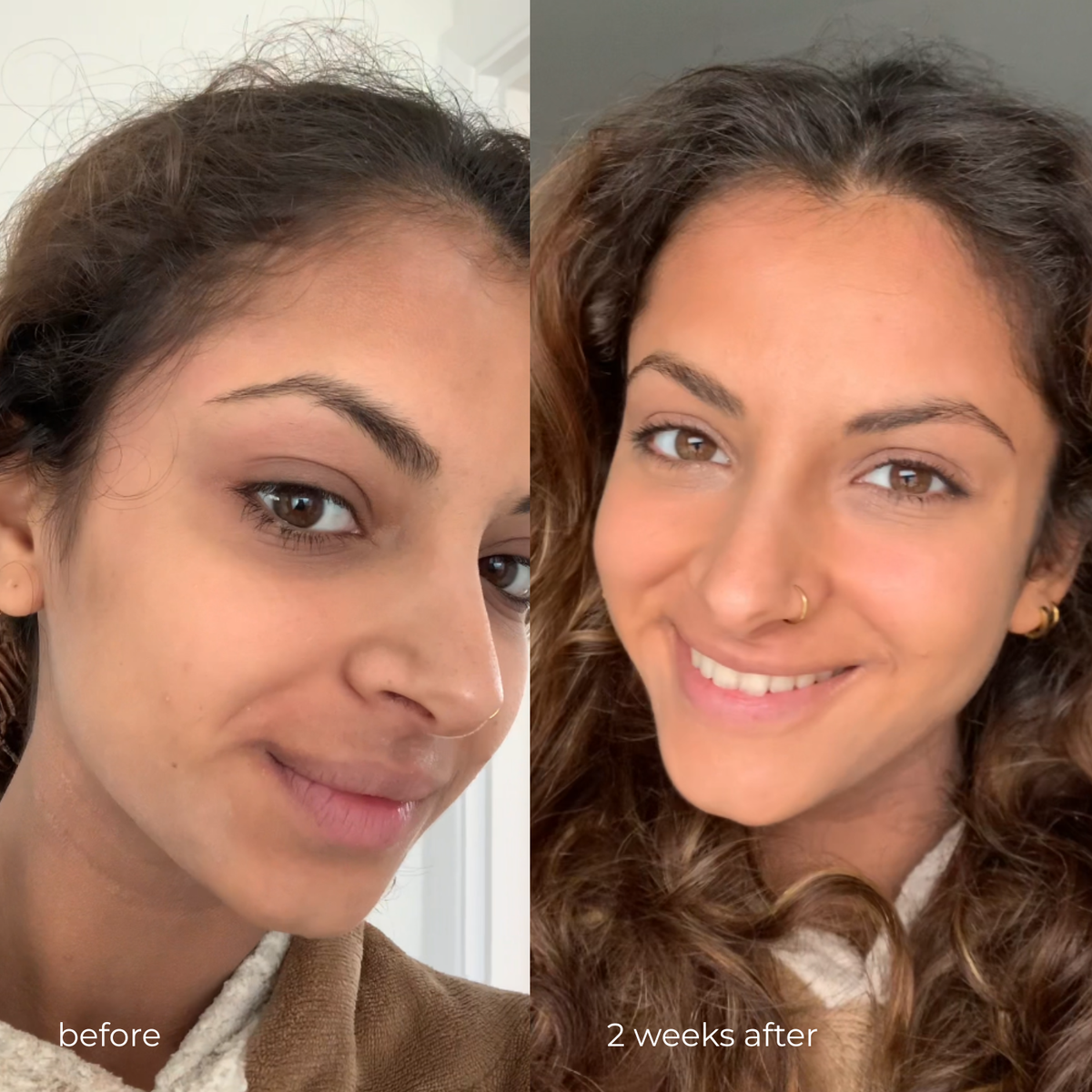 HA + PEPTIDES EYE CARE — before