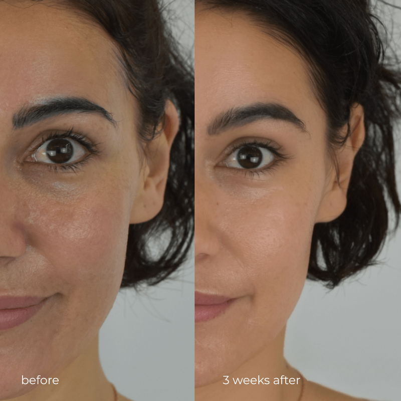 Before and after results using Active Drip Iconic Moisturiser
