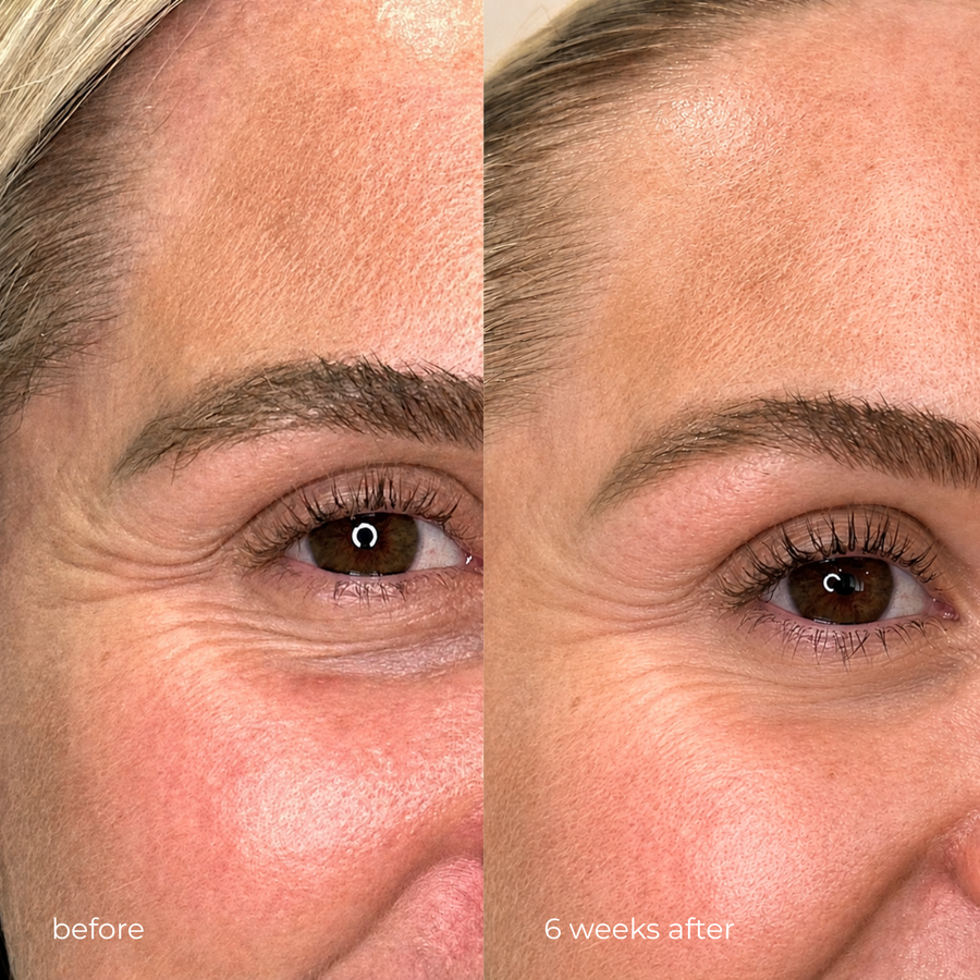 R-Q10 EYE CARE
