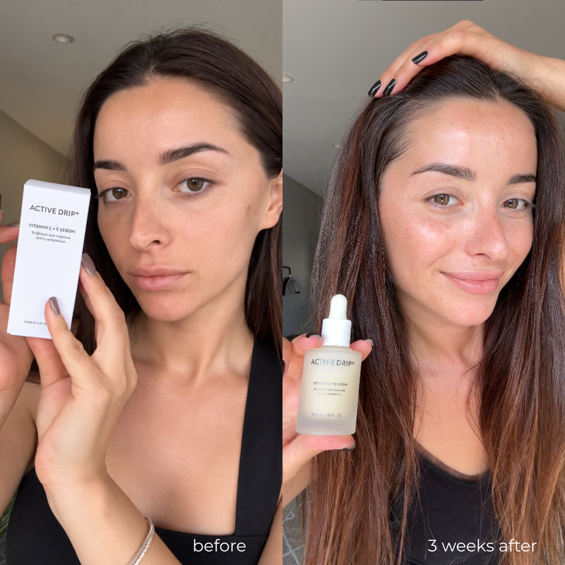 Before and after results using Active Drip C + E Drip serum