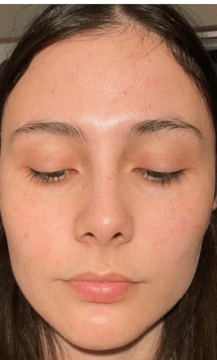 Laura · 6 weeks · Spot Reset Ritual — After